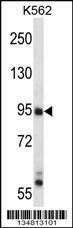 Anti-MAP3K10 Rabbit Polyclonal Antibody (HRP (Horseradish Peroxidase))