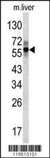 Anti-FIBB Rabbit Polyclonal Antibody