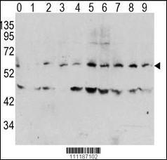 Anti-MYC Rabbit Polyclonal Antibody (AP (Alkaline Phosphatase))