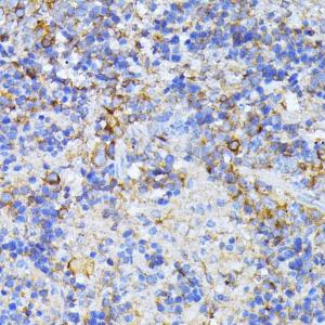 Immunohistochemistry analysis of paraffin-embedded mouse spleen using Anti-CAD/BM1 Antibody (A10396) at a dilution of 1:100 (40x lens) Perform microwave antigen retrieval with 10 mM PBS buffer pH 72 before commencing with IHC staining protocol