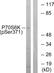 Western blot analysis of lysates from COLO205 cells treated with serum 20% 15' using Anti-p70 S6 Kinase (phospho Ser371) Antibody. The right hand lane represents a negative control, where the antibody is blocked by the immunising peptide.