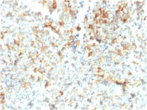 Immunohistochemical analysis of formalin-fixed, paraffin-embedded human testicular cancer using Anti-FCGRT Antibody [FCGRT/2932]