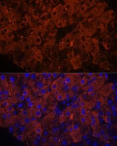 Anti-PNLIPRP1 antibody