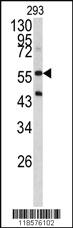 Anti-AOC1 Rabbit Polyclonal Antibody