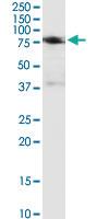 Anti-IFNGR1 Polyclonal Antibody Pair