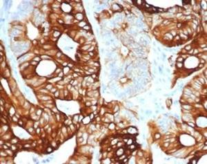 Anti-Cytokeratin 20 antibody