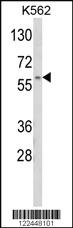 Anti-MCM4 Rabbit Polyclonal Antibody