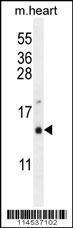 Anti-Gonadotropin-releasing Hormone Rabbit polyclonal antibody