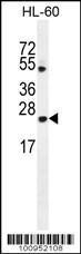 Anti-BAX Rabbit Polyclonal Antibody (HRP (Horseradish Peroxidase))