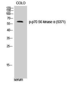 Western blot analysis of COLO cells using Anti-p70 S6 Kinase (phospho Ser371) Antibody