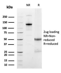 SDS-PAGE analysis of Anti-FCGRT Antibody [FCGRT/2932] under non-reduced and reduced conditions; showing intact IgG and intact heavy and light chains, respectively SDS-PAGE analysis confirms the integrity and purity of the antibody