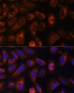 Immunofluorescence analysis of U-2 OS cells using Anti-CAD/BM1 Antibody (A10396) at a dilution of 1:100 DAPI was used to stain the cell nuclei (blue)