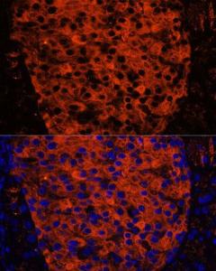 Anti-PNLIPRP1 antibody