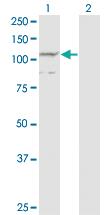 Anti-PCDHA7 Mouse Monoclonal Antibody [clone: 1C7]