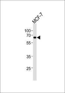 Anti-ESR2 Rabbit Polyclonal Antibody (Biotin)