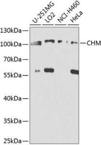 Western blot analysis of extracts of various cell lines, using Anti-CHM Antibody (A8345) at 1:1,000 dilution