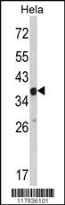 Anti-ARPC1A Rabbit Polyclonal Antibody