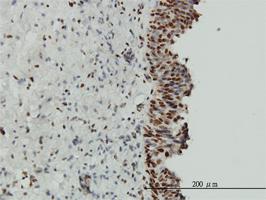 Anti-EWSR1 Mouse Monoclonal Antibody [clone: 5C10]