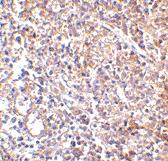 Anti-LY96 Mouse Monoclonal Antibody [clone: 9F1B1]