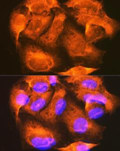 Anti-PHKG2 antibody