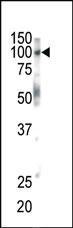 Anti-EPHB1 Rabbit Polyclonal Antibody