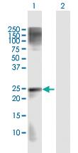 Anti-MAD2L2 Rabbit Polyclonal Antibody