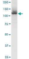 Anti-HIP1R Mouse Polyclonal Antibody