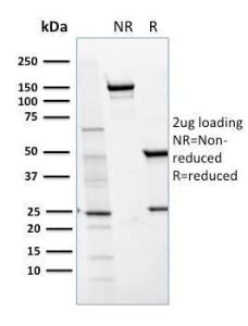 SDS-PAGE analysis of Anti-CD36 Antibody [GPIIIb/1654] under non-reduced and reduced conditions; showing intact IgG and intact heavy and light chains, respectively. SDS-PAGE analysis confirms the integrity and purity of the antibody.