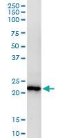 Anti-MAD2L2 Rabbit Polyclonal Antibody