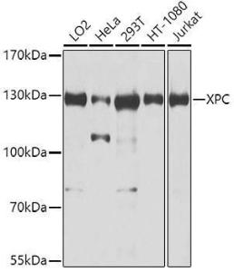 Anti-XPC Rabbit Polyclonal Antibody