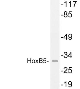 Western blot analysis of lysate from HUVEC cells using Anti-HoxB5 Antibody