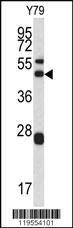 Anti-ARPC1A Rabbit Polyclonal Antibody