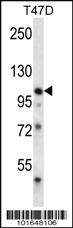 Anti-EPHB1 Rabbit Polyclonal Antibody