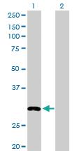 Anti-MLF2 Rabbit Polyclonal Antibody