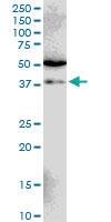 Anti-SIAH1 Mouse Monoclonal Antibody [clone: 2C5]