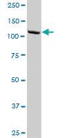 Anti-HIP1R Mouse Polyclonal Antibody