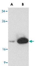 Anti-LY96 Mouse Monoclonal Antibody [clone: 9F1B1]