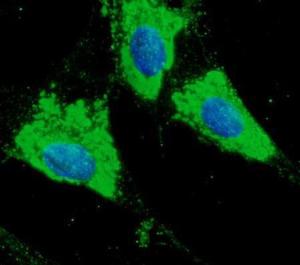 Primary RPE cells, fixed with 4% PFA, stained with Anti-ERp57 Antibody at a 1:100 dilution