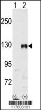 Anti-EPHB1 Rabbit Polyclonal Antibody