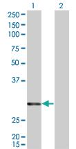 Anti-ATF2 Mouse Monoclonal Antibody [clone: 4C12]