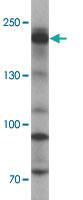 Anti-SHROOM3 Rabbit Polyclonal Antibody