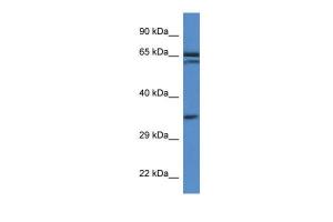 Anti-TERF2IP Rabbit Polyclonal Antibody