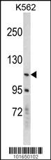 Anti-EPHB2 Rabbit Polyclonal Antibody