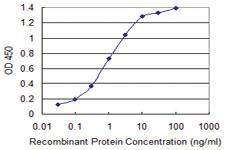 Anti-SIAH1 Mouse Monoclonal Antibody [clone: 2C5]