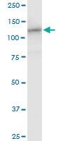 Anti-HIP1R Mouse Polyclonal Antibody