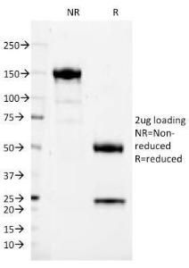 SDS-PAGE analysis of Anti-CD37 Antibody [IPO-24] under non-reduced and reduced conditions; showing intact IgG and intact heavy and light chains, respectively SDS-PAGE analysis confirms the integrity and purity of the antibody