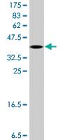 Anti-VASH1 Mouse Polyclonal Antibody