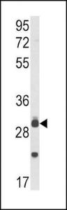 Anti-MYD88 Rabbit Polyclonal Antibody (AP (Alkaline Phosphatase))