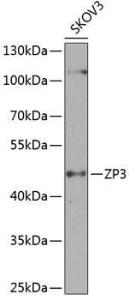 Western blot analysis of extracts of SKOV3 cells, using Anti-ZP3 Antibody (A10401) at 1:1000 dilution