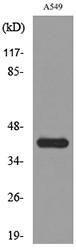 Western blot analysis of lysate from A549 cells using Anti-SELL Antibody